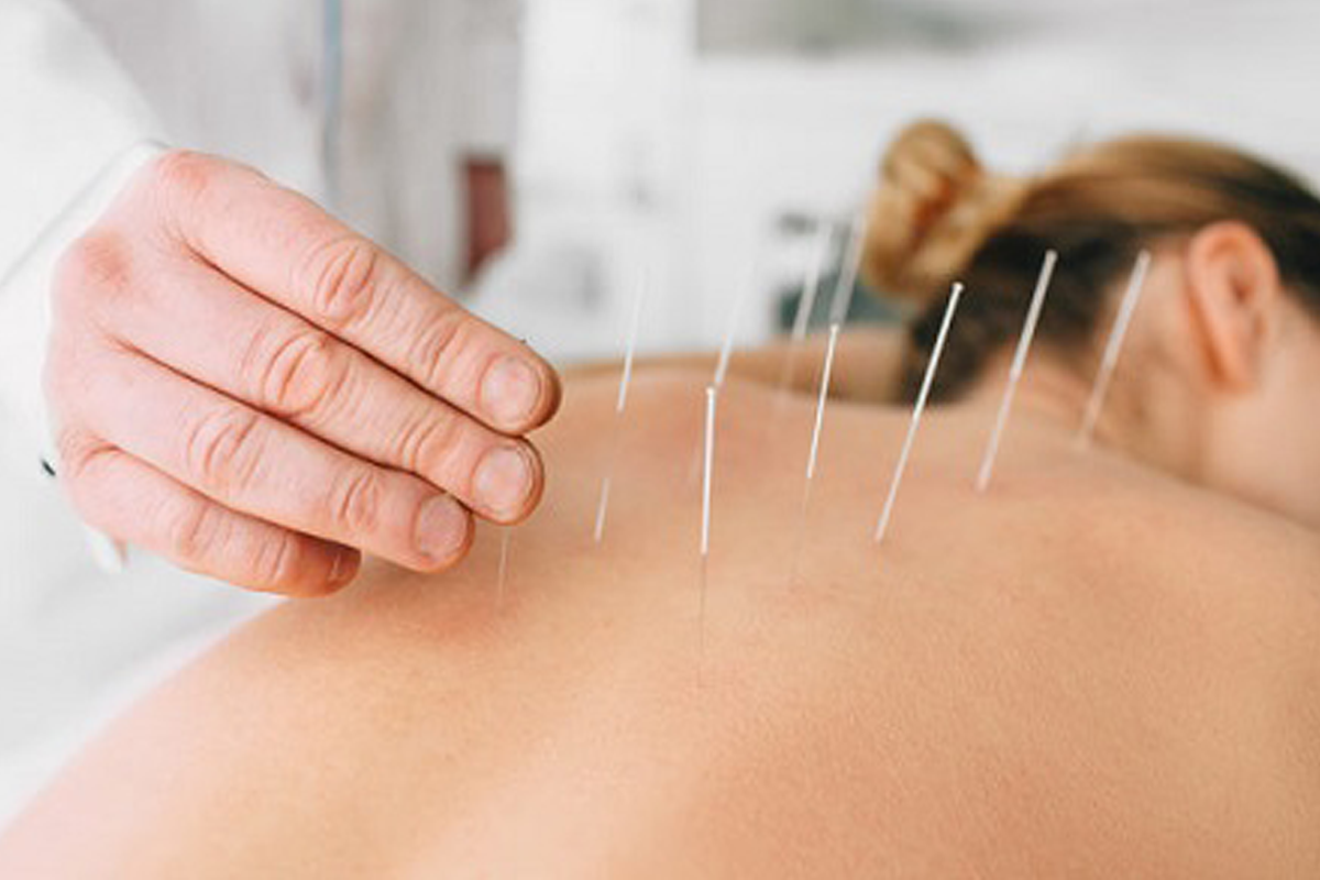 https://www.abctest123.a2hosted.com/wp-content/uploads/2020/09/Acupuncture-Procedures-updated.png
