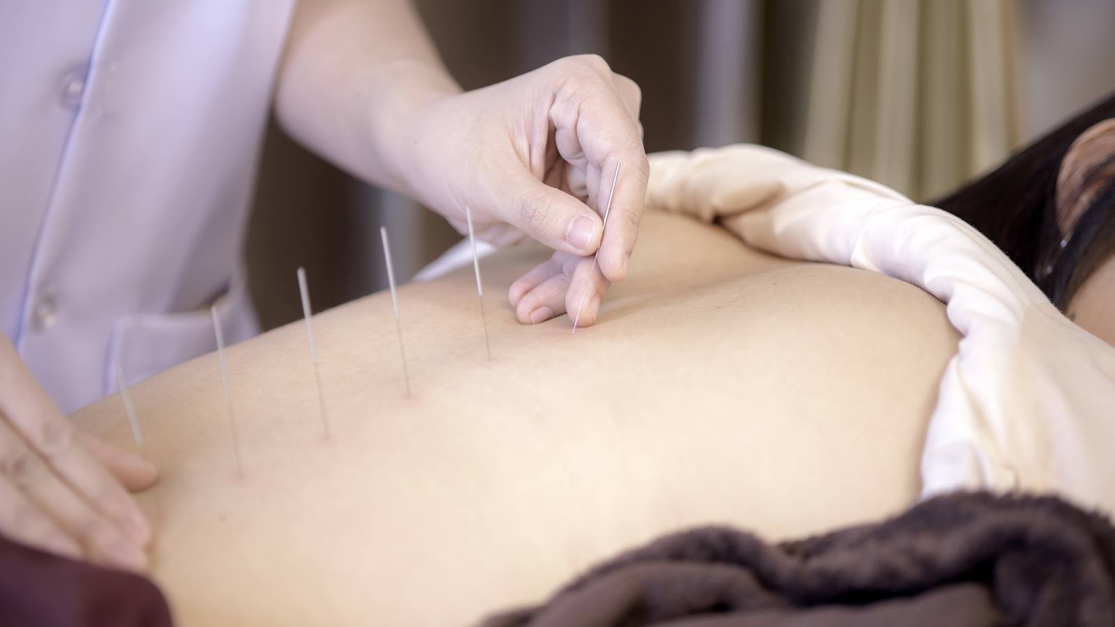 https://www.abctest123.a2hosted.com/wp-content/uploads/2020/09/Why-I-Love-Acupuncture.jpg
