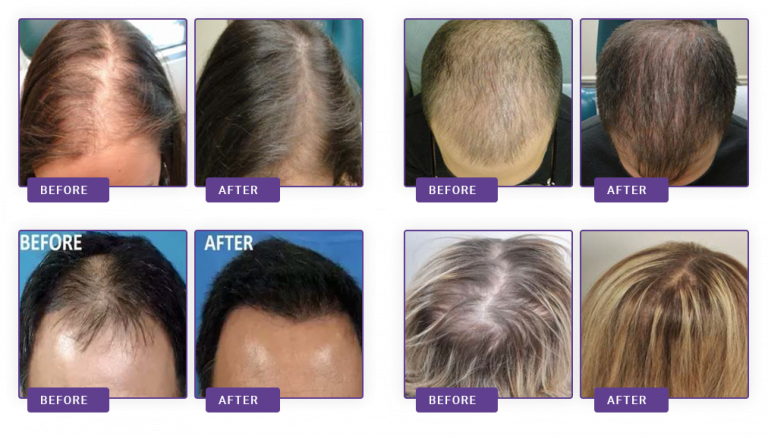 https://www.abctest123.a2hosted.com/wp-content/uploads/2020/09/after-before-hair-768x436-1.png
